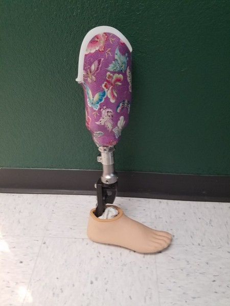 Prosthetic leg with a colorful butterfly design